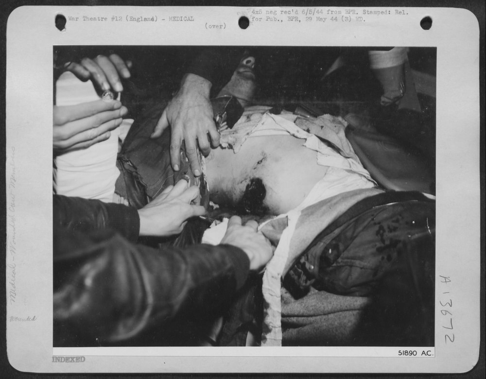 PRICE OF VICTORY-This wounded Flying ofrtress gunner has just been